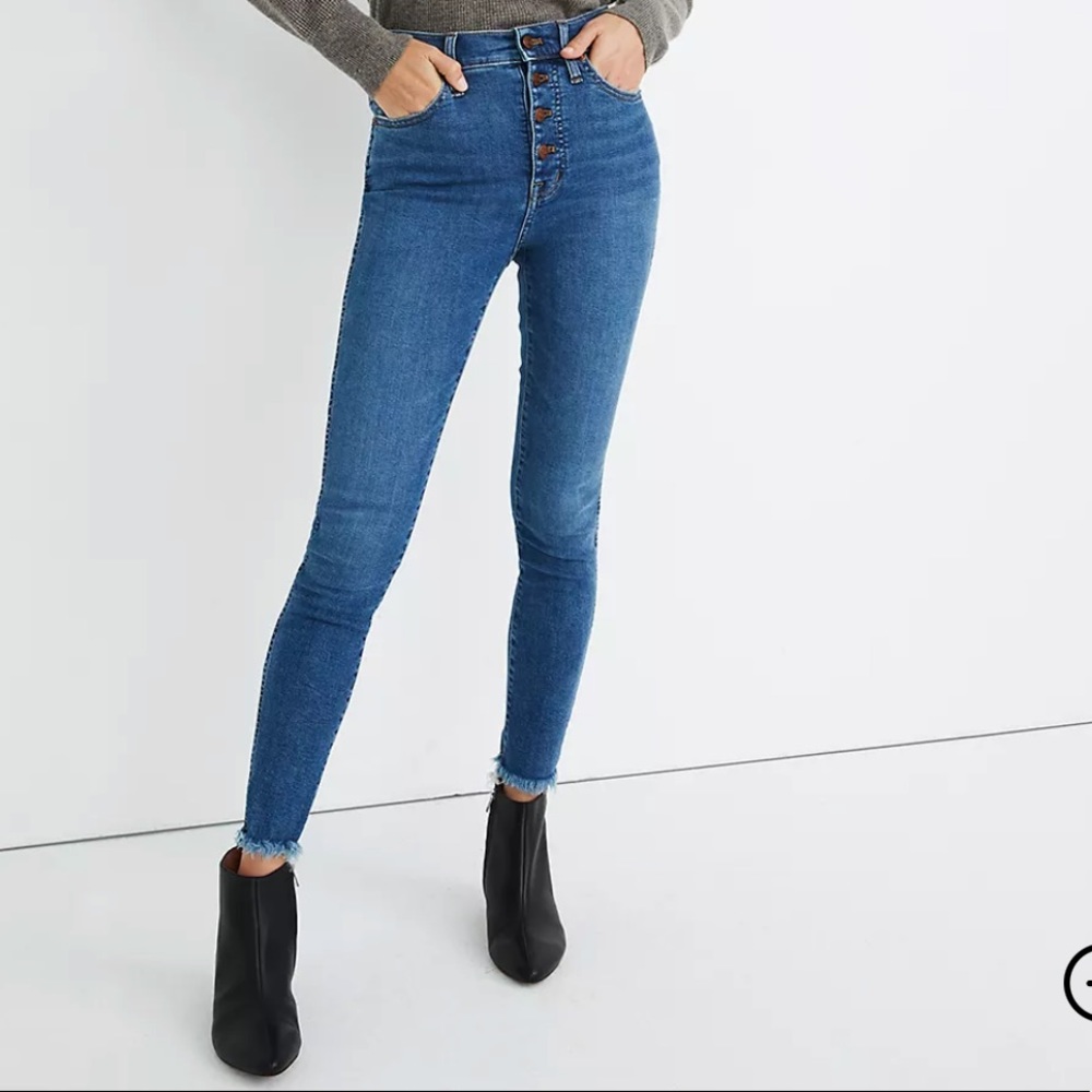Madewell Button Fly 10” Rise Skinny Jeans